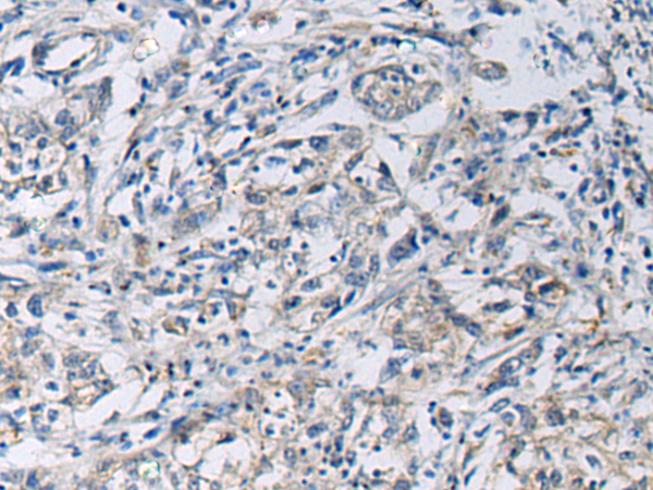 Rabbit Polyclonal Antibody to KCNJ10