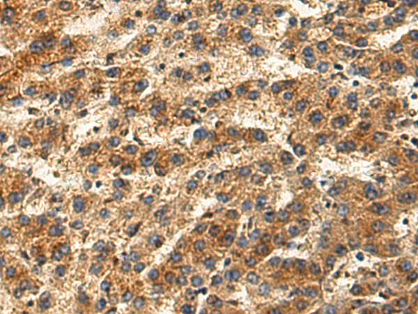 Rabbit Polyclonal Antibody to GP2