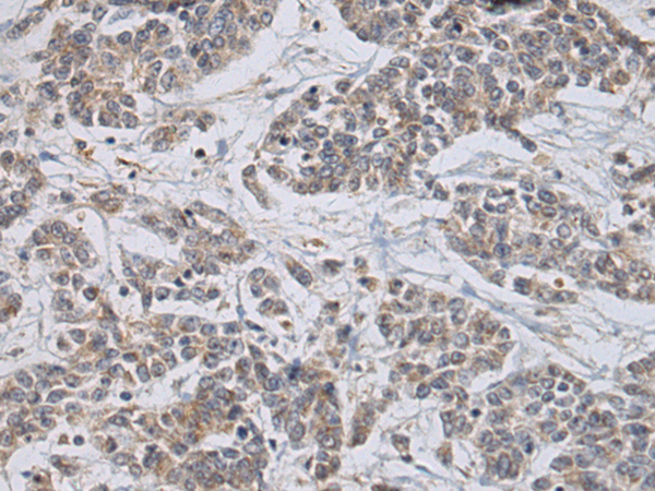 Rabbit Polyclonal Antibody to PRELP
