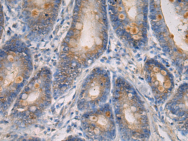 Rabbit Polyclonal Antibody to MAPKAPK3