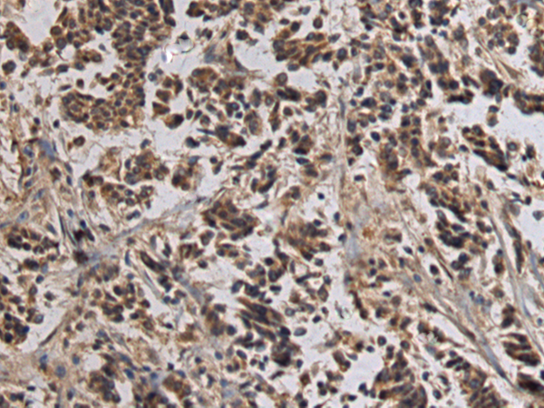 Rabbit Polyclonal Antibody to TLL1