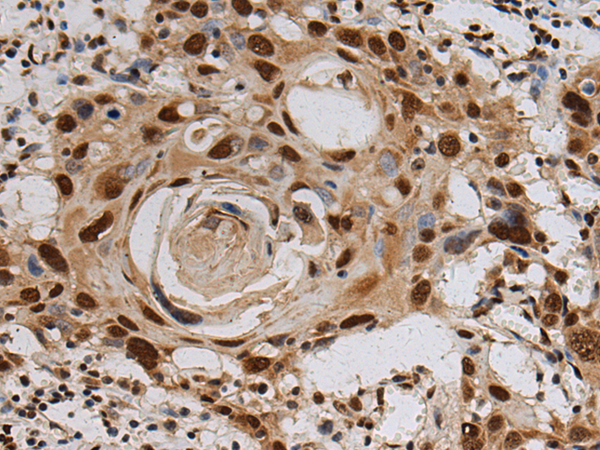 Rabbit Polyclonal Antibody to KIN