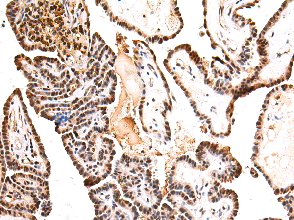 Rabbit Polyclonal Antibody to PHAX