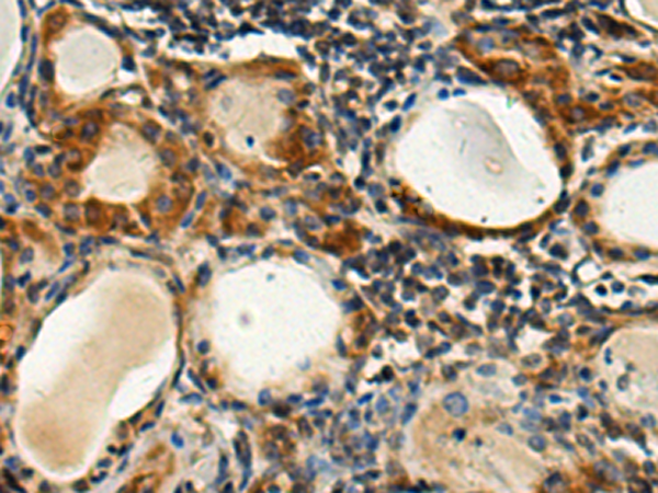 Rabbit Polyclonal Antibody to MRPS31