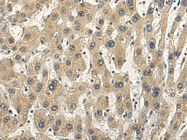 Rabbit Polyclonal Antibody to STOML1