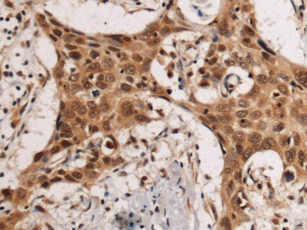 Rabbit Polyclonal Antibody to KLF12