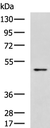 Rabbit Polyclonal Antibody to STK32B