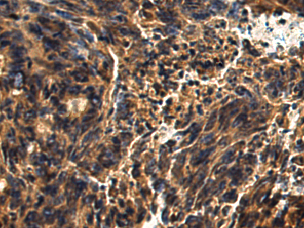 Rabbit Polyclonal Antibody to CBLIF