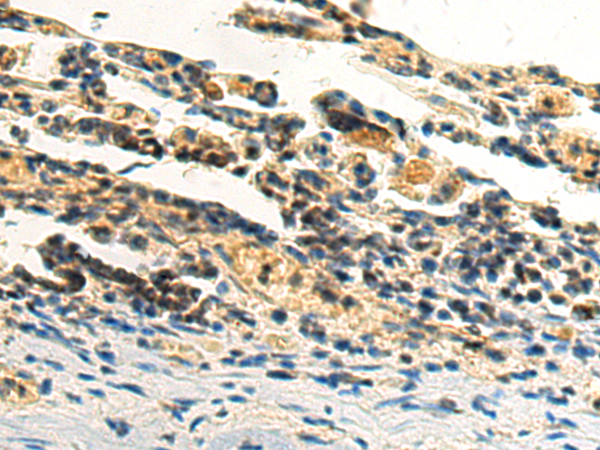 Rabbit Polyclonal Antibody to BCS1L