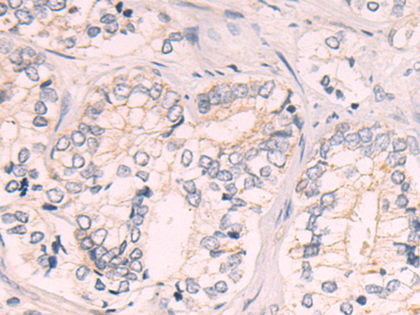 Rabbit Polyclonal Antibody to MRPS30