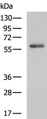 Rabbit Polyclonal Antibody to MAOB
