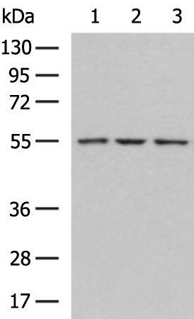 Rabbit Polyclonal Antibody to HEXA