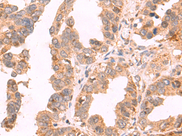 Rabbit Polyclonal Antibody to GDPD2