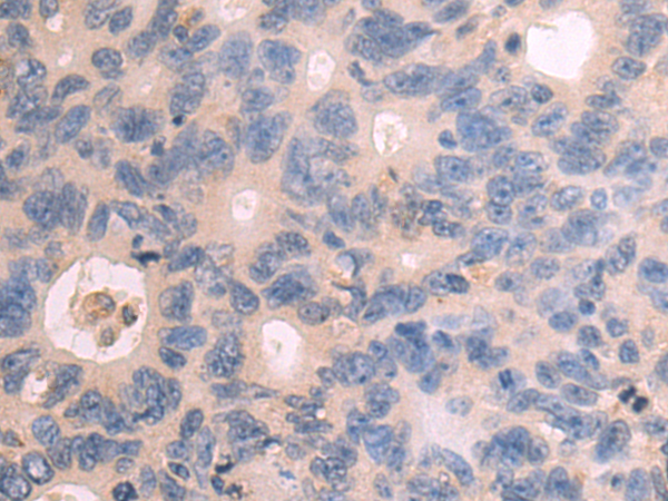 Rabbit Polyclonal Antibody to GNS