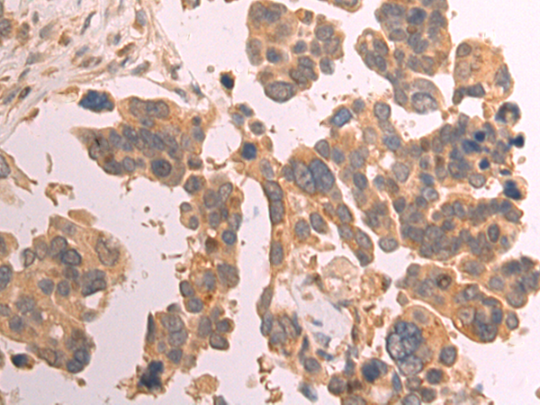 Rabbit Polyclonal Antibody to COLGALT2