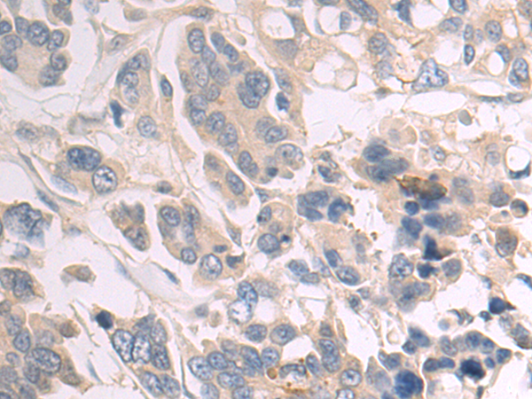 Rabbit Polyclonal Antibody to GBE1