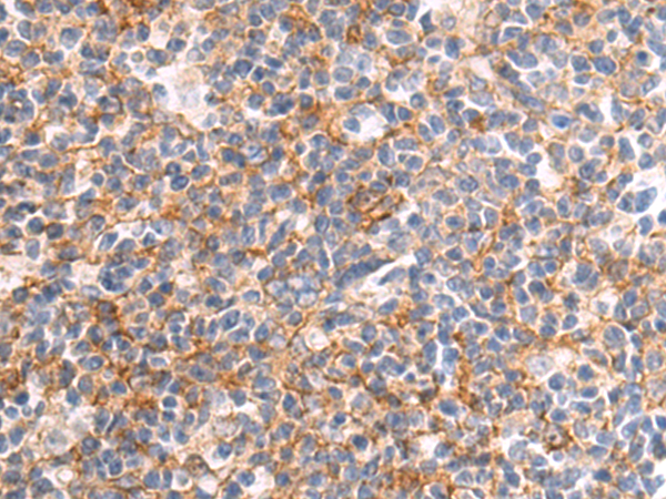 Rabbit Polyclonal Antibody to CMTR2