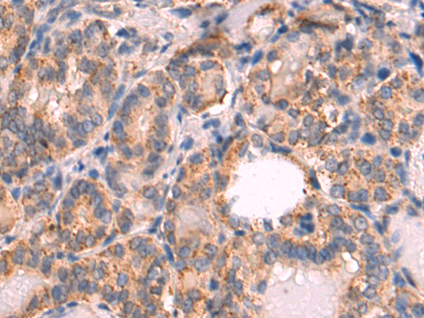 Rabbit Polyclonal Antibody to HGS