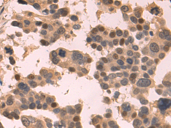 Rabbit Polyclonal Antibody to POLE3