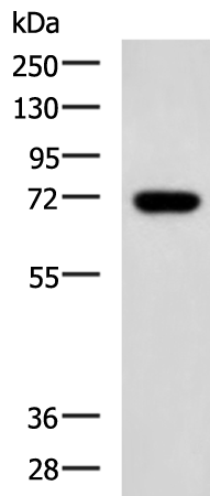 Rabbit Polyclonal Antibody to ENTPD4