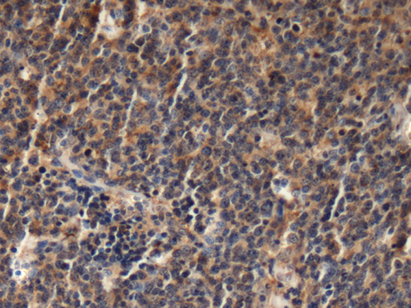 Rabbit Polyclonal Antibody to EML1