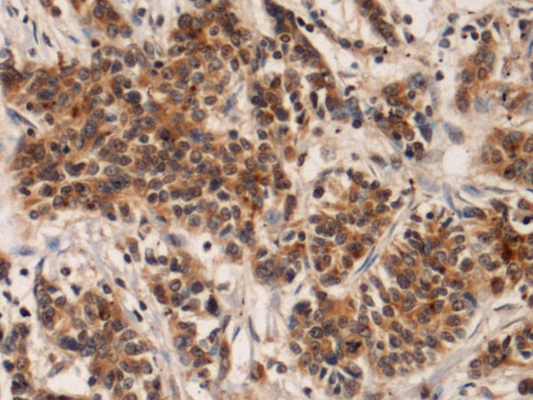 Rabbit Polyclonal Antibody to IQSEC1
