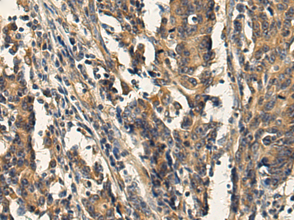 Rabbit Polyclonal Antibody to AP3B1