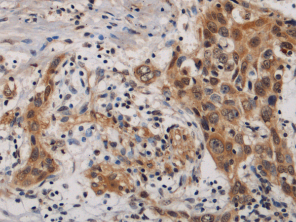 Rabbit Polyclonal Antibody to TIMM10B