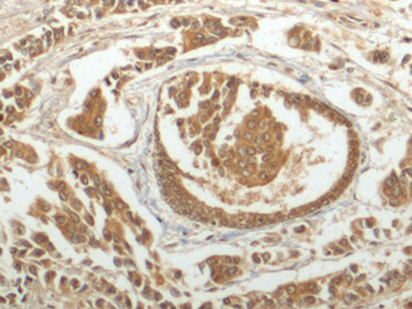 Rabbit Polyclonal Antibody to DYNLRB1