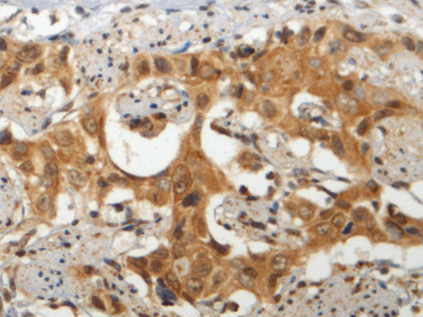 Rabbit Polyclonal Antibody to GEMIN6