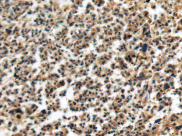 Rabbit Polyclonal Antibody to FIBIN