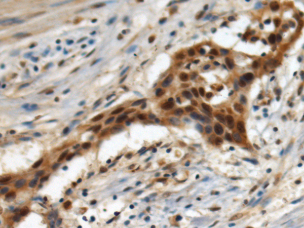 Rabbit Polyclonal Antibody to EIF3G