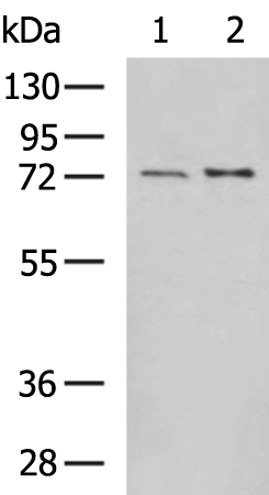 Rabbit Polyclonal Antibody to GUCY1B1