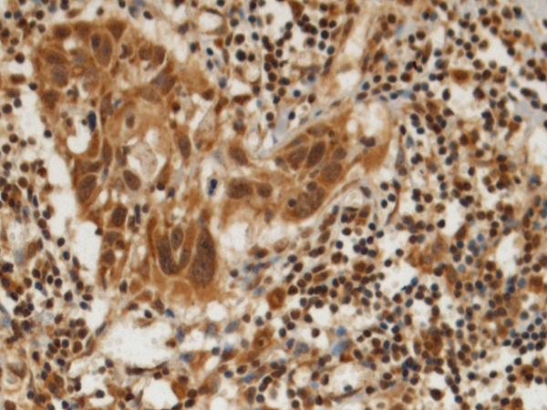 Rabbit Polyclonal Antibody to DHX8