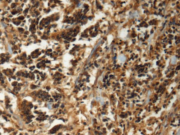 Rabbit Polyclonal Antibody to GAN