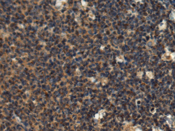 Rabbit Polyclonal Antibody to DNALI1