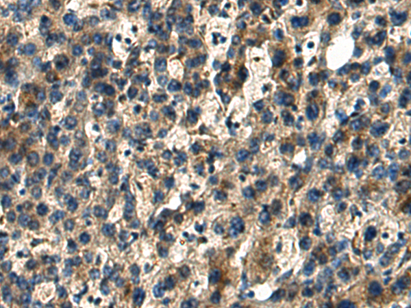 Rabbit Polyclonal Antibody to DUSP15
