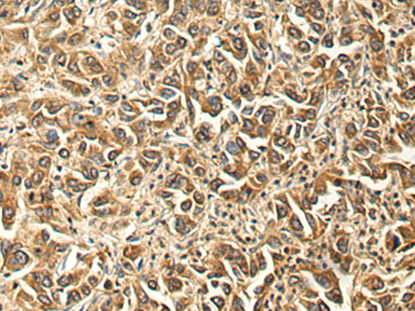 Rabbit Polyclonal Antibody to FRMD5