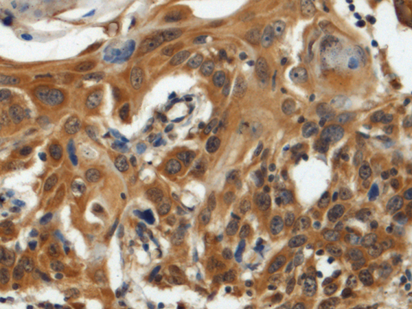 Rabbit Polyclonal Antibody to GTPBP2