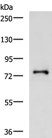 Rabbit Polyclonal Antibody to GALNT3