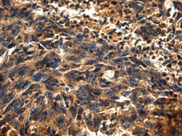 Rabbit Polyclonal Antibody to GBA3