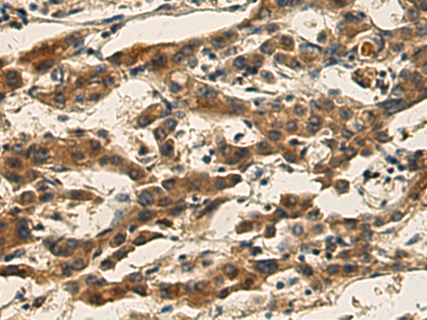 Rabbit Polyclonal Antibody to GPLD1