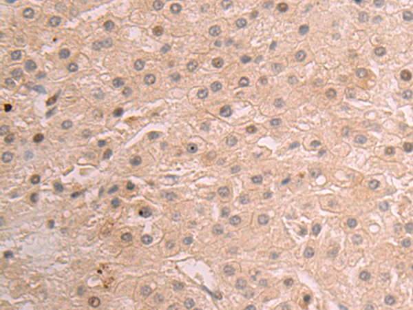 Rabbit Polyclonal Antibody to GALNT1