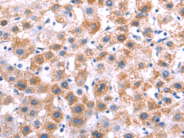 Rabbit Polyclonal Antibody to SPINK1