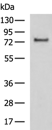 Rabbit Polyclonal Antibody to FBXO42