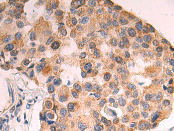 Rabbit Polyclonal Antibody to KCTD18
