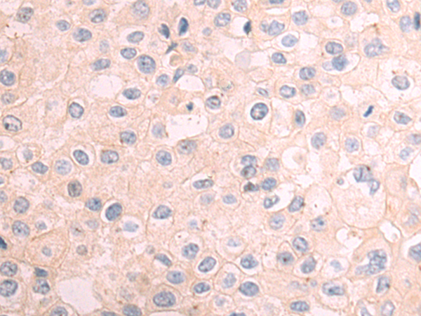 Rabbit Polyclonal Antibody to DNAJC11