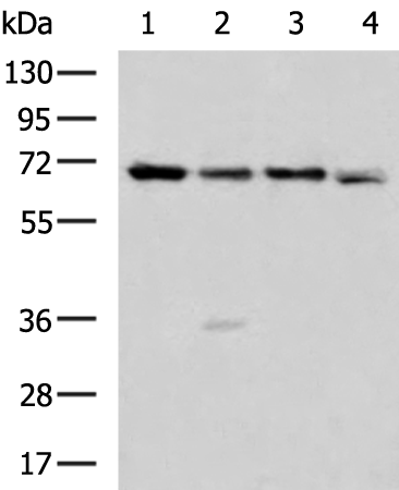 Rabbit Polyclonal Antibody to EED