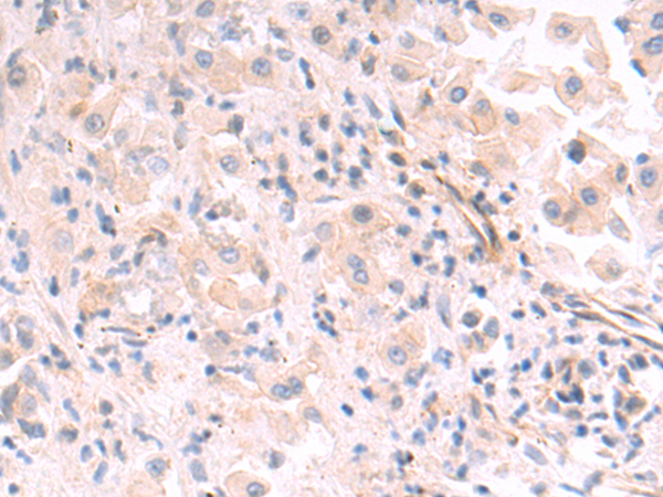 Rabbit Polyclonal Antibody to RBP3