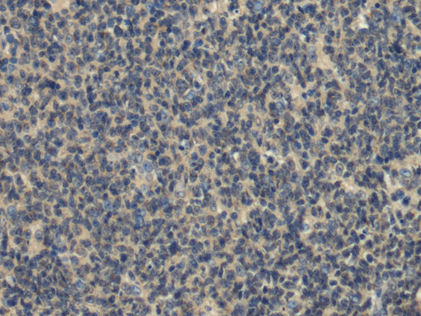 Rabbit Polyclonal Antibody to FCSK
